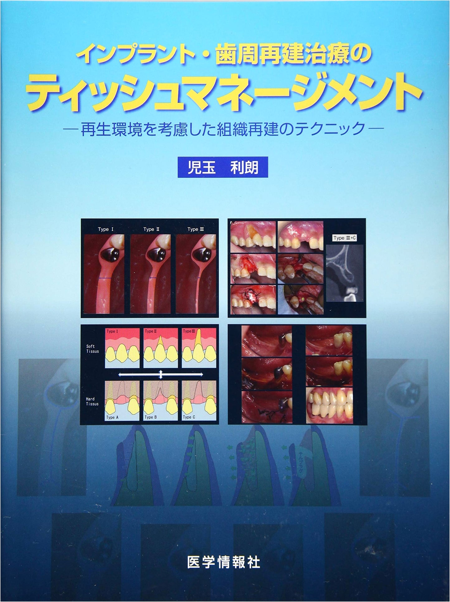 Implant & Periodontal Regeneration Tissue Management: Reconstruction Techniques