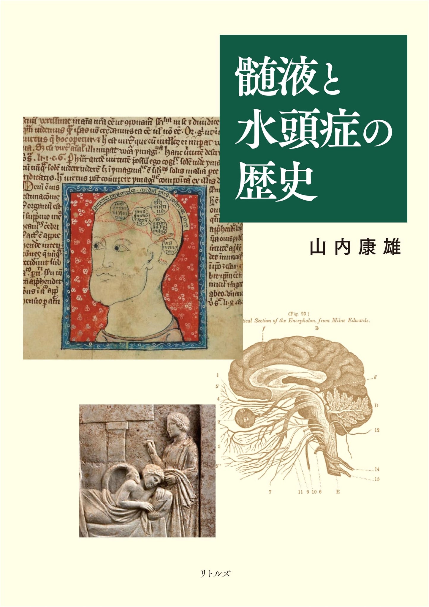 A History of Cerebrospinal Fluid and Hydrocephalus by Yasuo Yamauchi