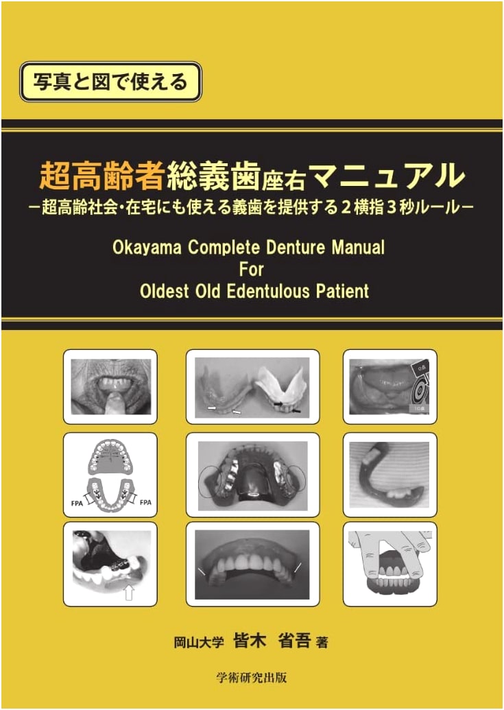 Manual for Complete Dentures in Super-Elderly: Photos & Illustrations
