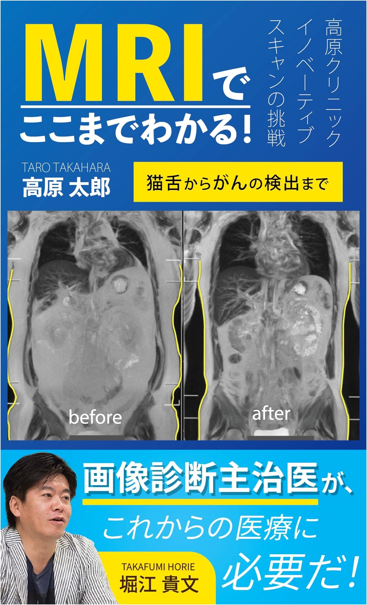 MRI: From Tongue Diagnosis to Cancer Detection - Taro Takahara