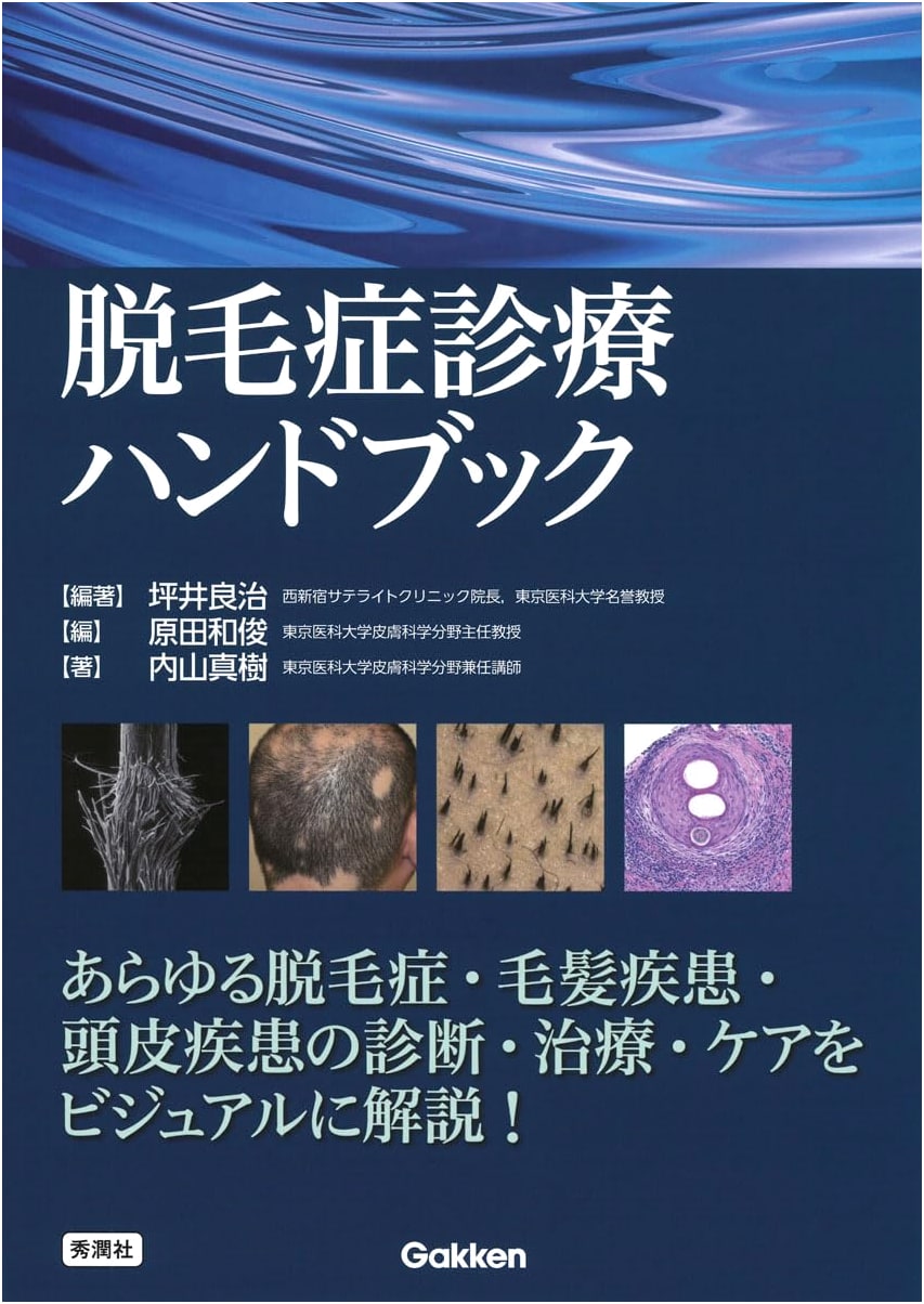 Handbook of Alopecia Diagnosis and Treatment