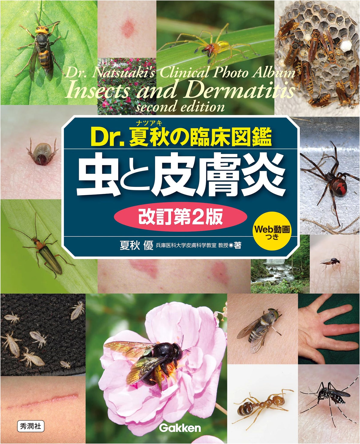 Dr. Natsuaki's Clinical Guide: Insects and Dermatitis, Revised 2nd Ed.