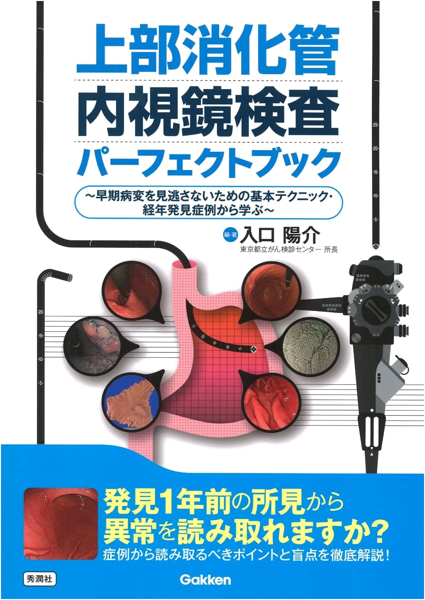 Upper GI Endoscopy Perfect Book: Techniques & Case Studies for Early Lesion Detection