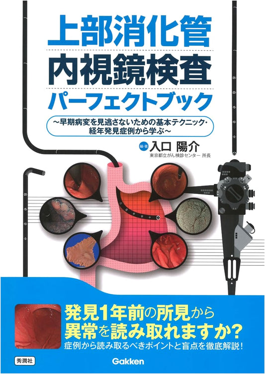 Upper GI Endoscopy Perfect Book: Techniques & Case Studies for Early Lesion Detection