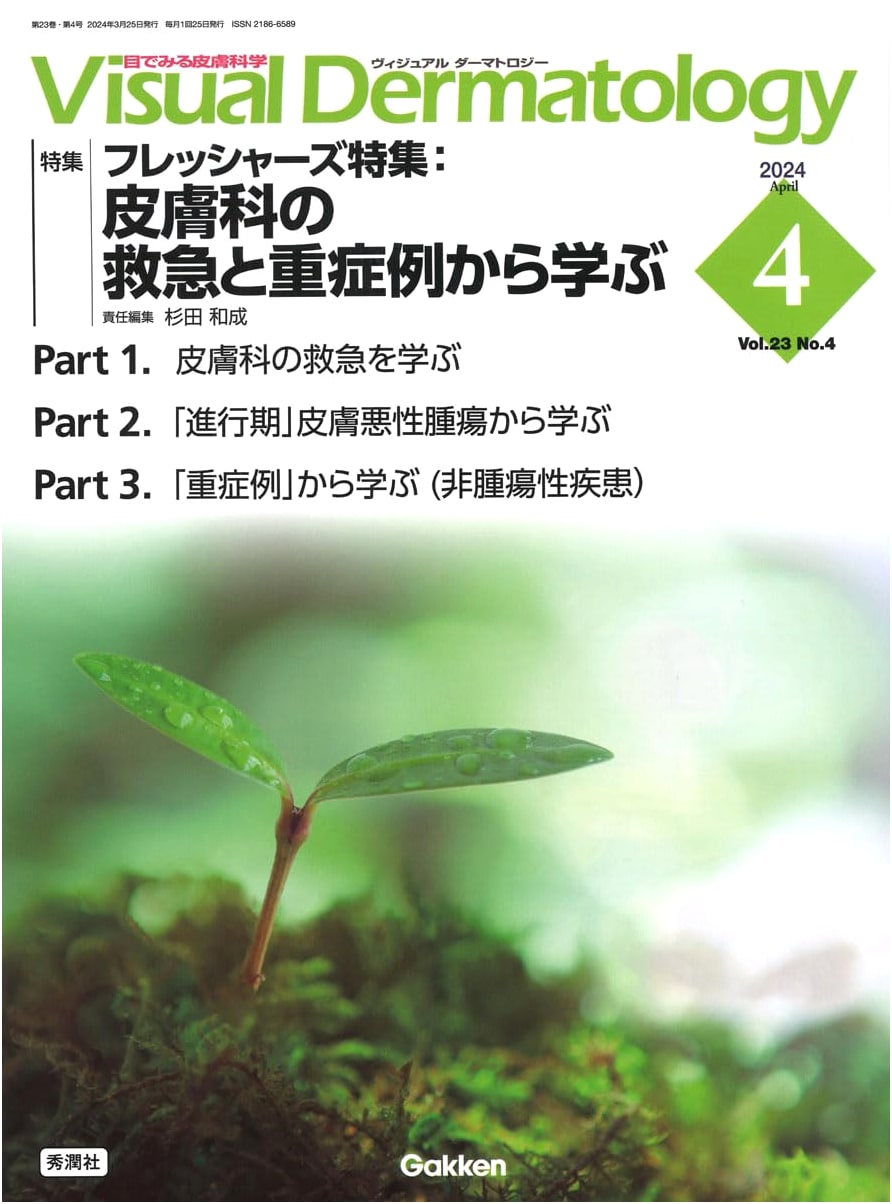 Visual Dermatology: April 2024, Vol. 23 No. 4 - Gakken Medical Journal