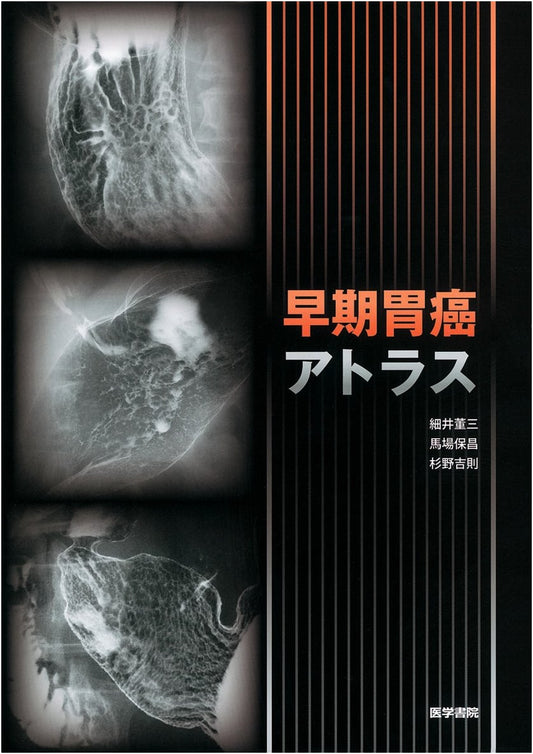 Atlas of Early Stage Gastric Cancer