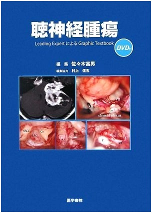 Acoustic Neuroma with DVD: Graphic Textbook by Leading Experts