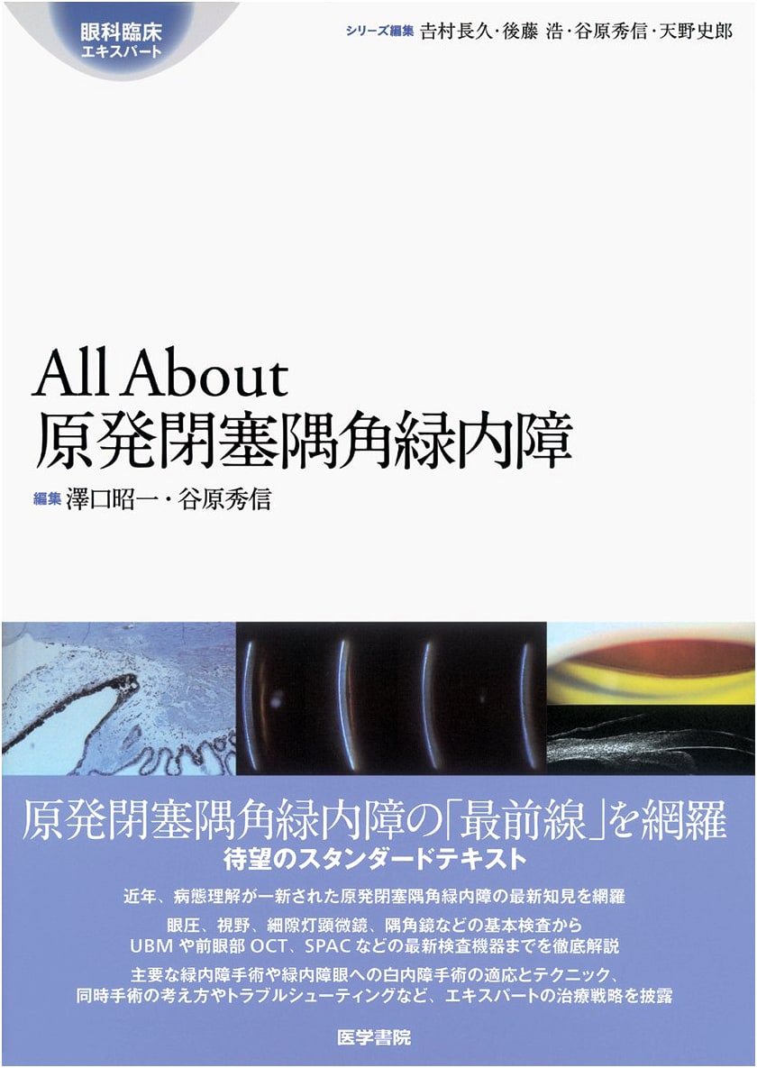 All About Primary Angle-Closure Glaucoma (Ophthalmology Clinical Expert Series)
