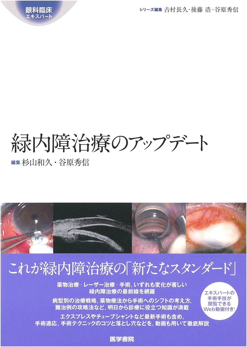 Glaucoma Treatment Update (Ophthalmology Clinical Expert)