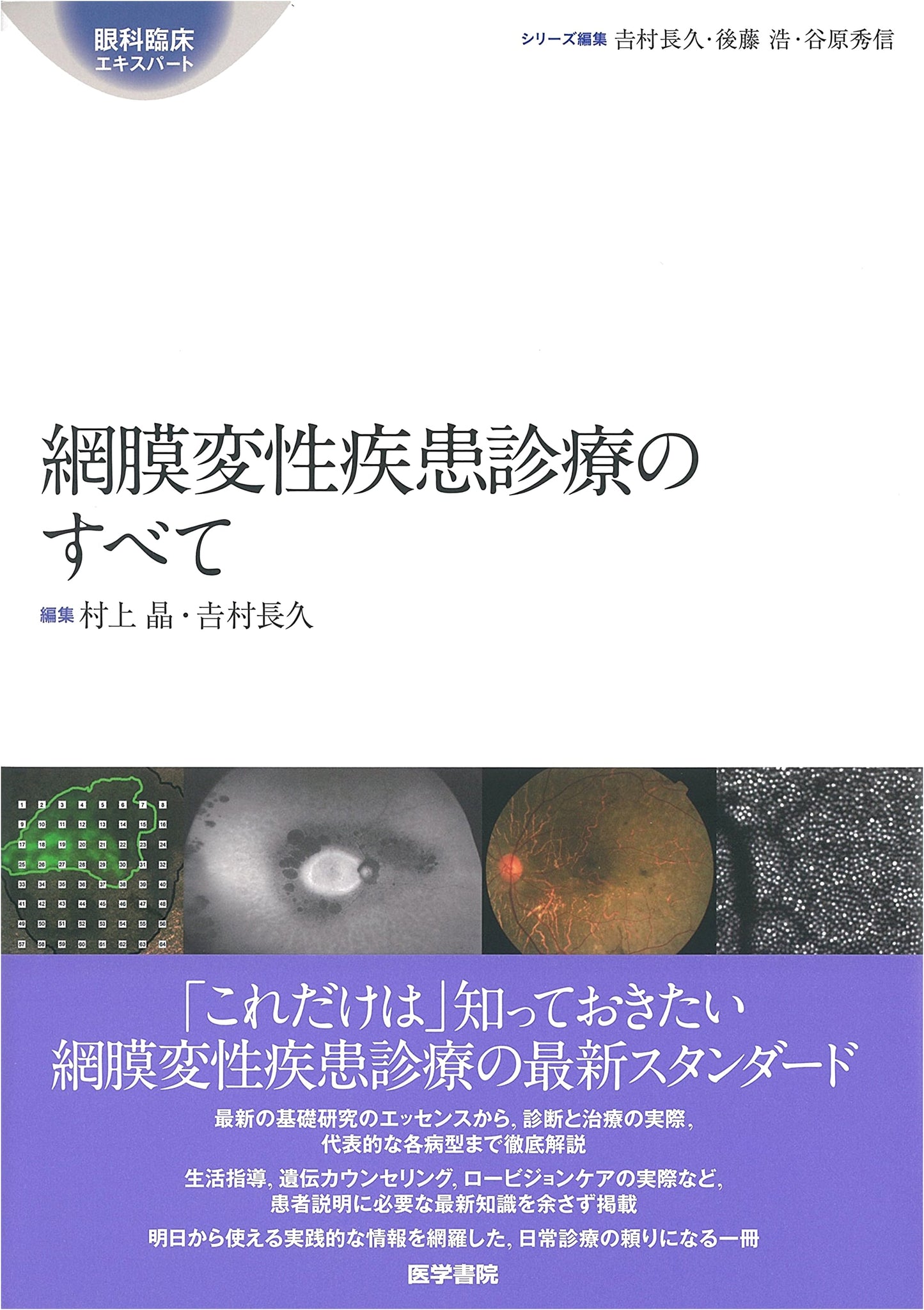 Comprehensive Guide to Retinal Degenerative Diseases: An Ophthalmology Clinical Expert Handbook