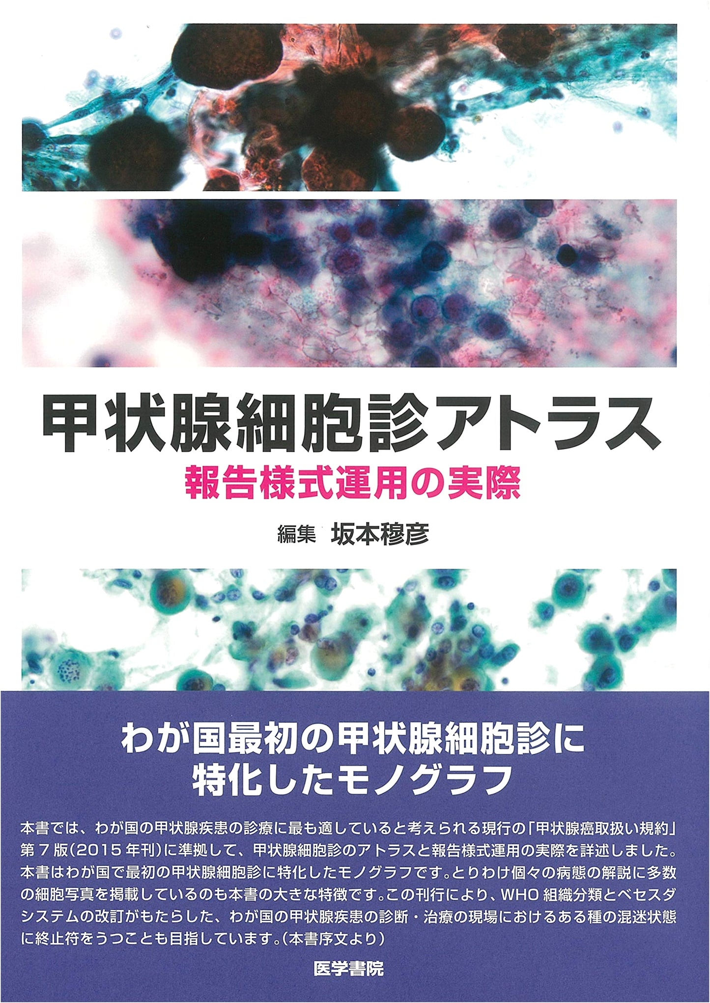 Thyroid Cytology Atlas: Practical Application of Reporting Forms