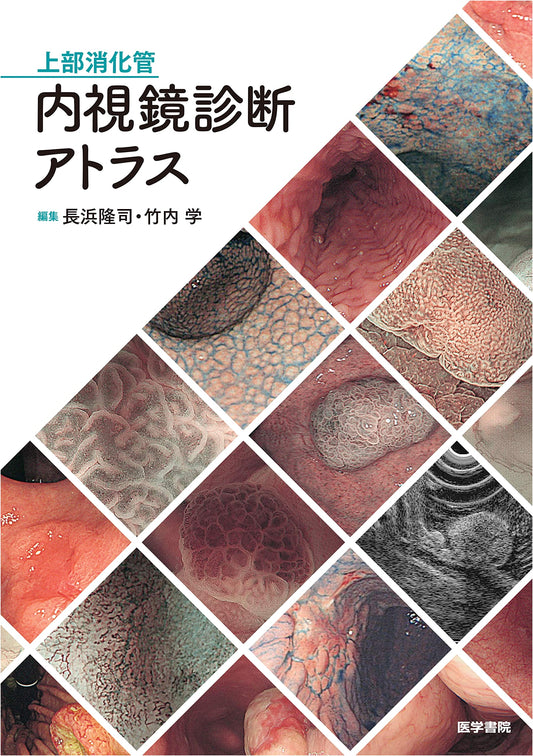 Atlas of Upper Gastrointestinal Endoscopic Diagnosis