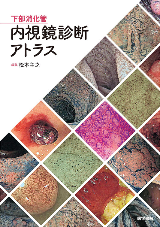 Atlas of Lower Gastrointestinal Endoscopic Diagnosis