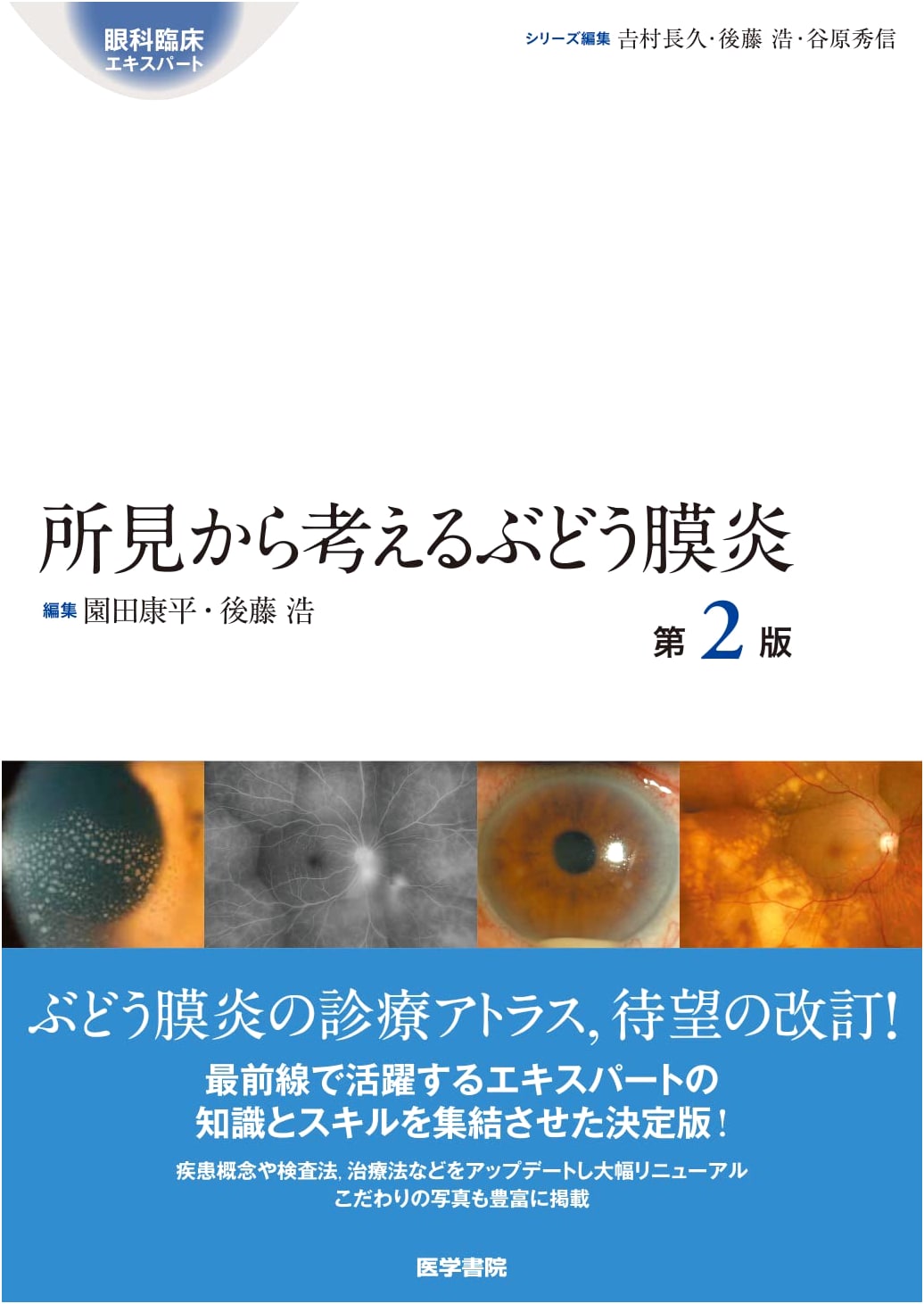 Uveitis: Clinical Expert Series - Understanding from Findings, 2nd Edition