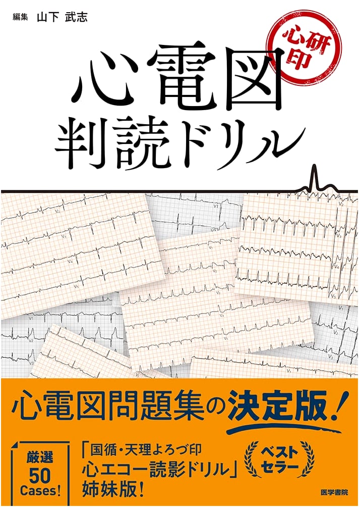 ECG Interpretation Drill Book: Sharpen Your Diagnostic Skills