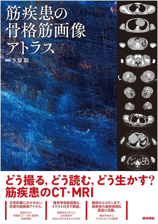 Skeletal Muscle Imaging Atlas of Muscle Diseases