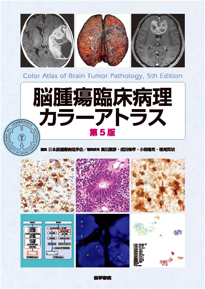 Clinical Pathology Color Atlas of Brain Tumors, 5th Edition