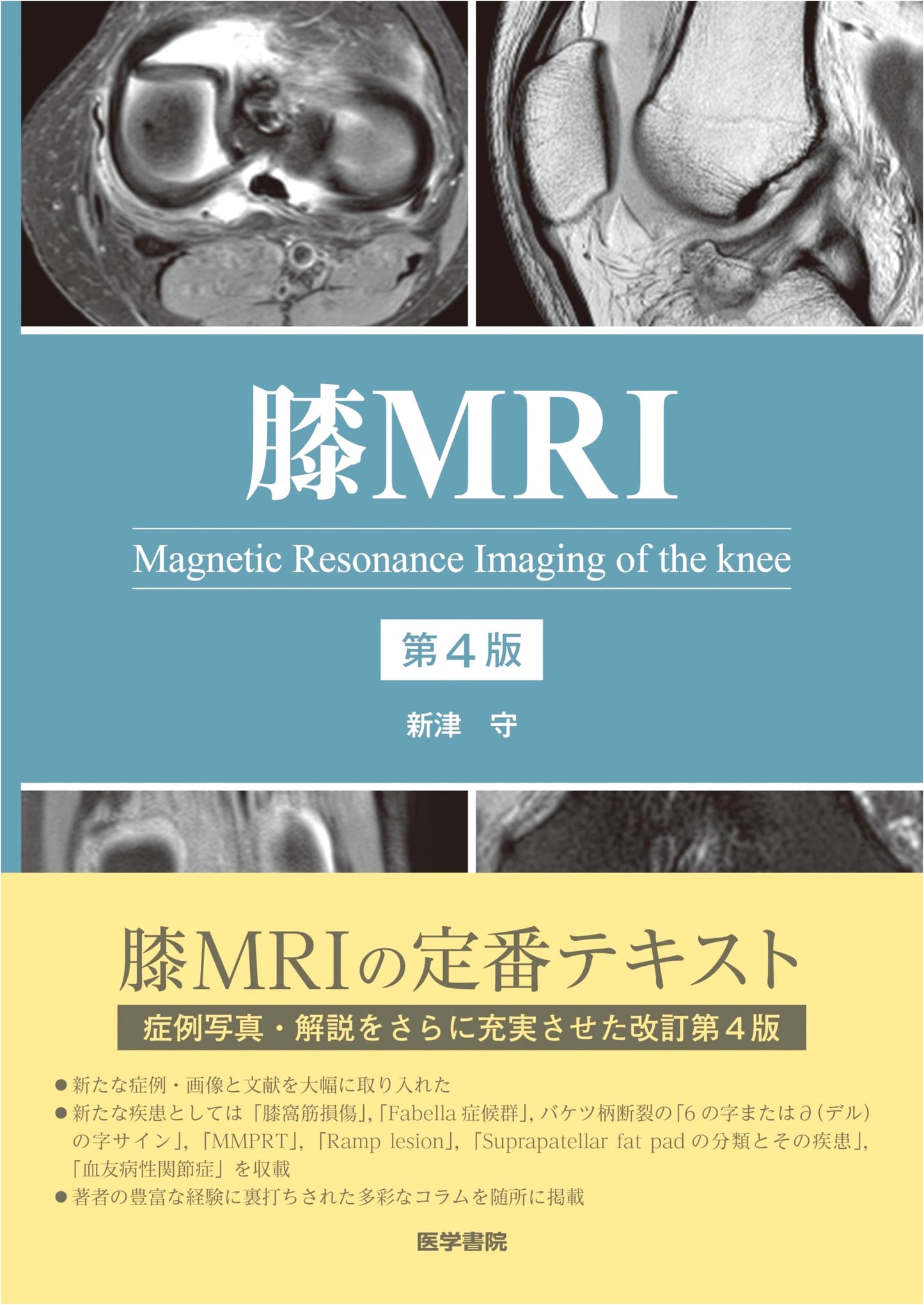 Knee MRI 4th Edition