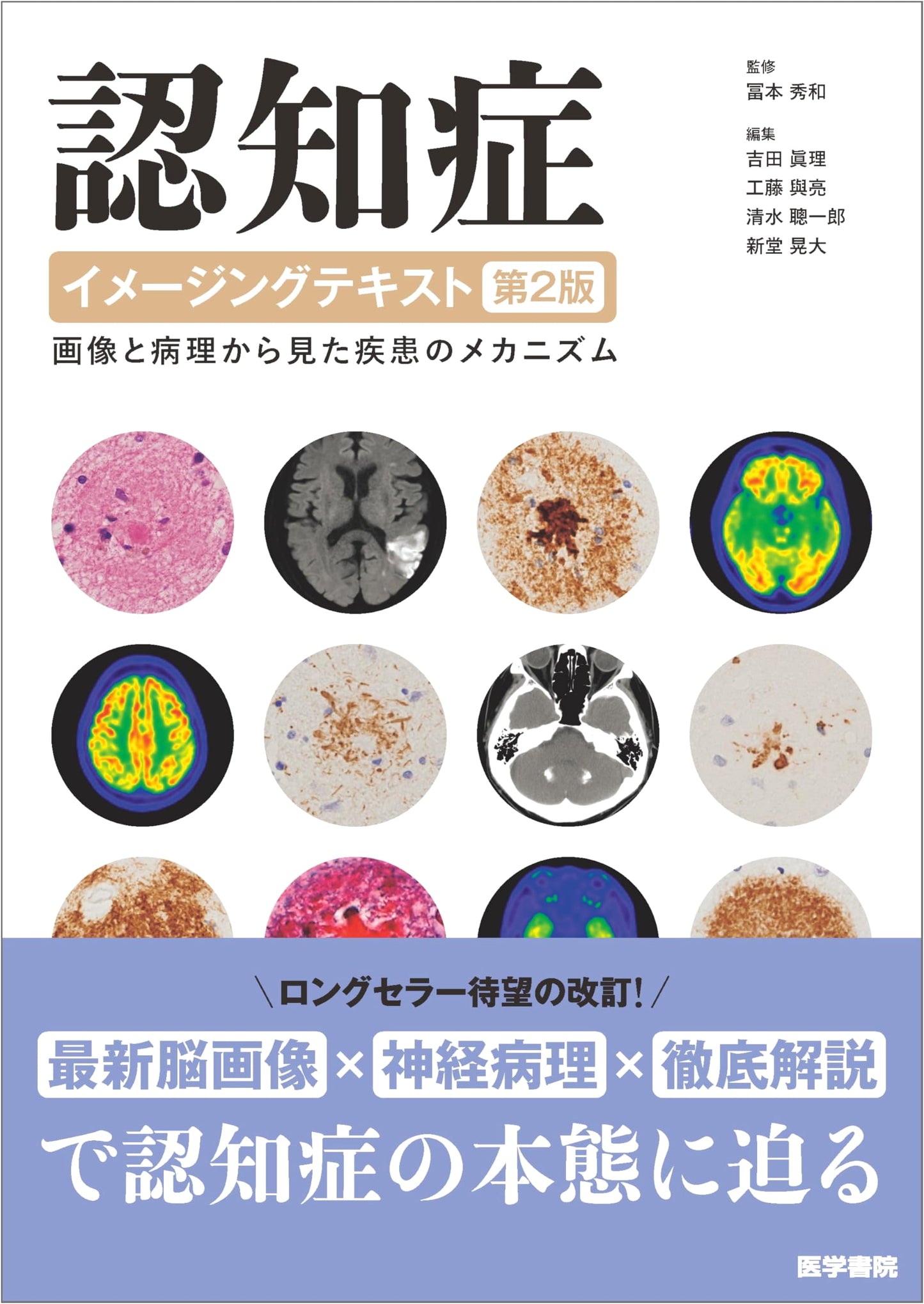 Dementia Imaging Text, 2nd Ed: Disease Mechanisms from Images & Pathology