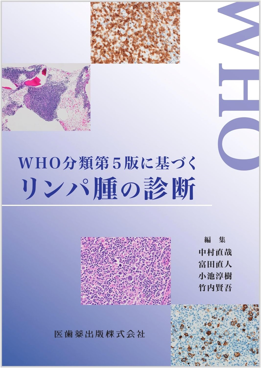 Diagnosis of Lymphoma Based on the WHO Classification 5th Edition