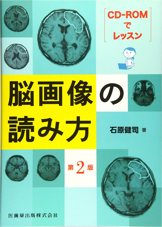 Brain Imaging Interpretation: Lessons with CD-ROM, 2nd Edition