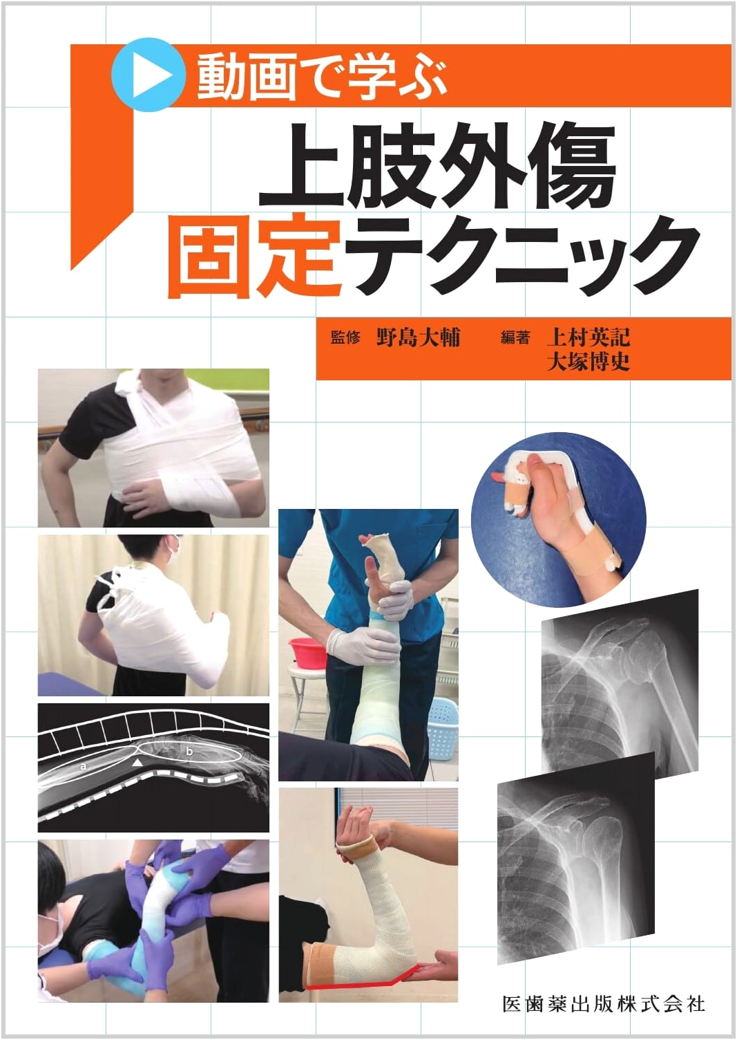 Upper Limb Trauma Fixation Techniques: A Video-Guided Learning Approach