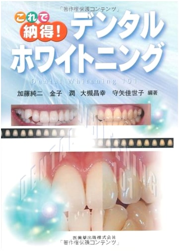 Dental Whitening: Understand it Now! - A Comprehensive Guide