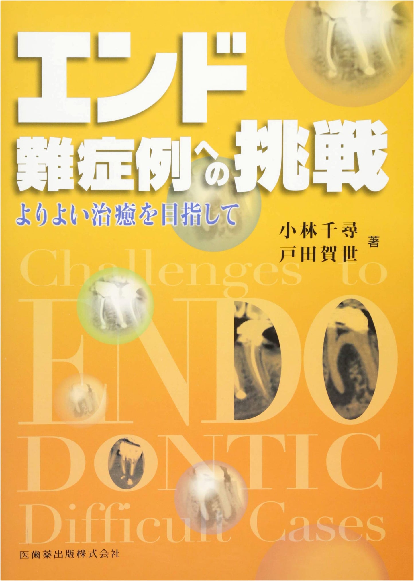 Challenging Difficult Endodontic Cases: Aiming for Better Healing