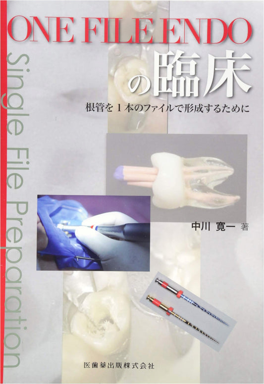 Clinical Practice of One File Endo: Root Canal Shaping with a Single File
