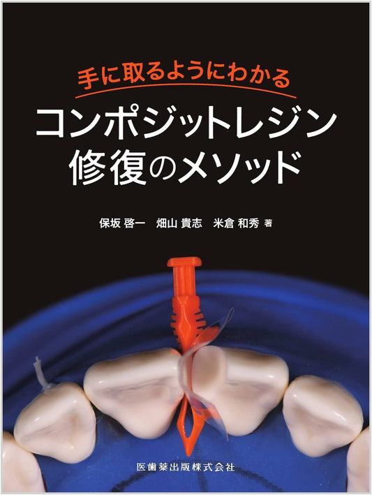 Composite Resin Restoration Methods: An Easy-to-Understand Guide