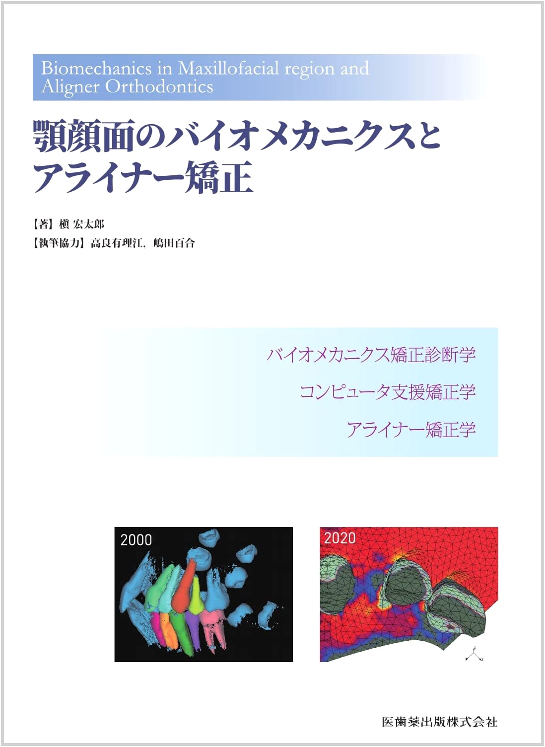 Biomechanics and Aligner Orthodontics of the Maxillofacial Region