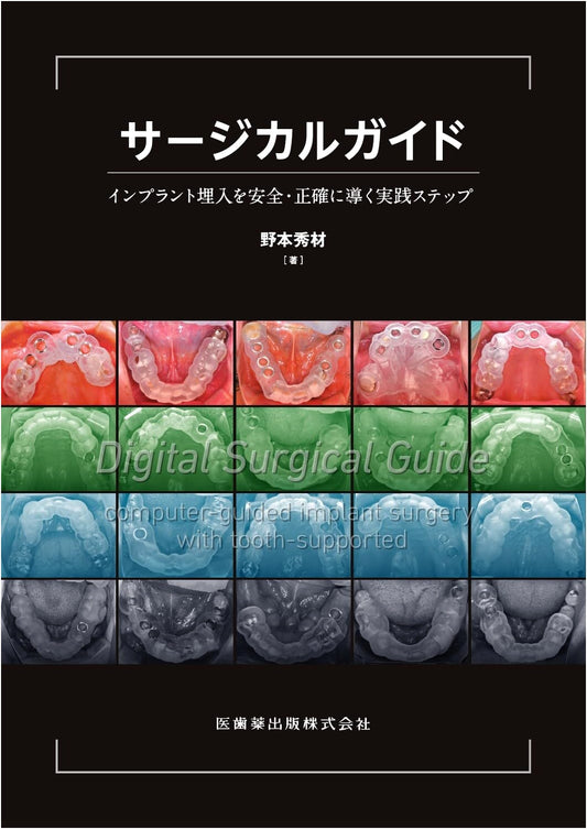 Surgical Guide: Practical Steps for Safe and Precise Implant Placement