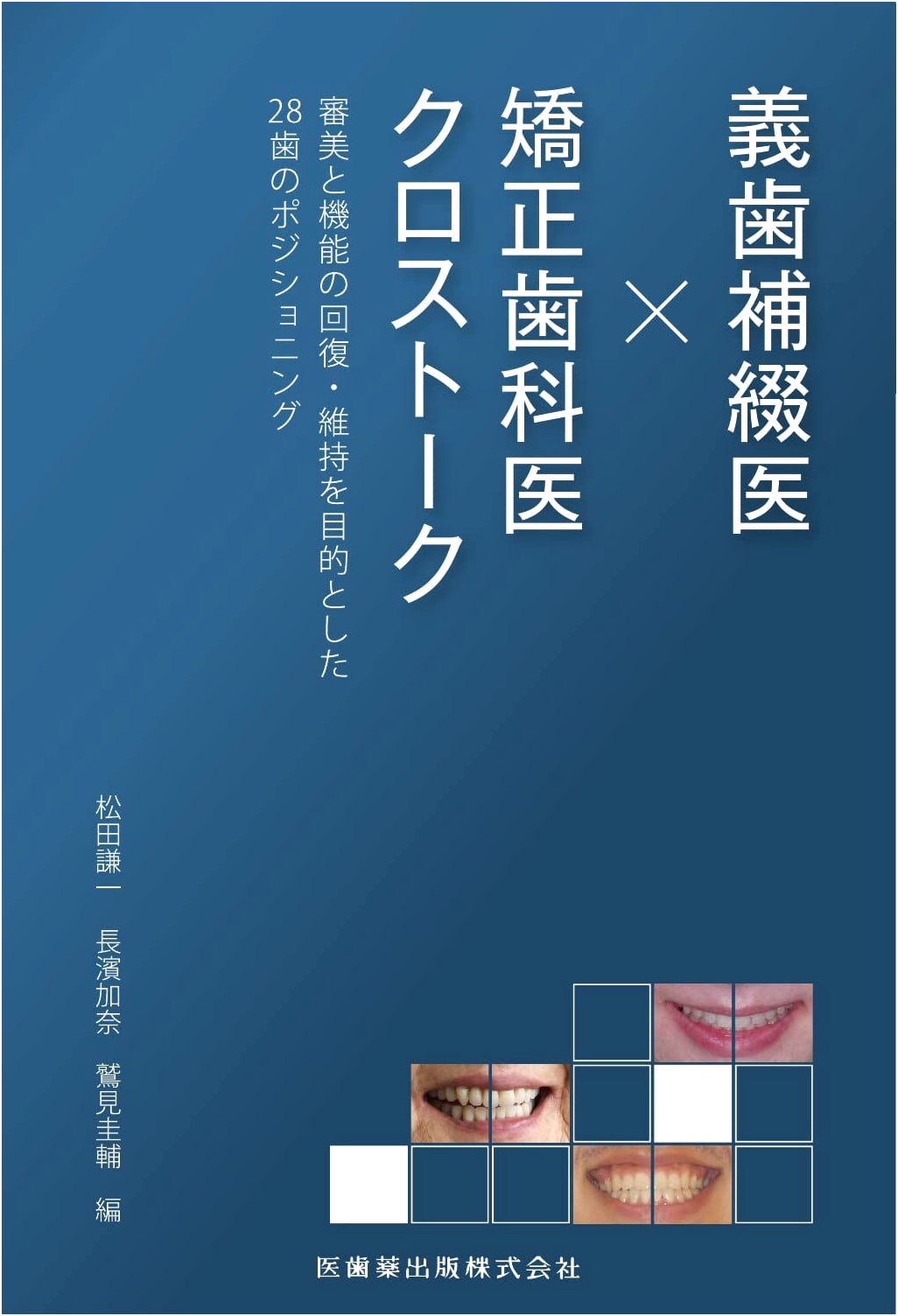 Prosthodontist x Orthodontist Crosstalk: 28-Tooth Positioning for Aesthetic & Functional Recovery