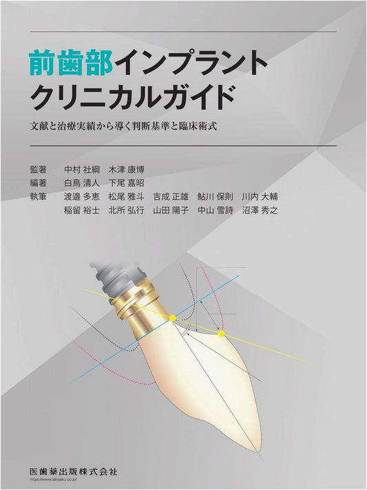 Anterior Dental Implant Clinical Guide: Decision-Making and Procedures from Evidence and Practice