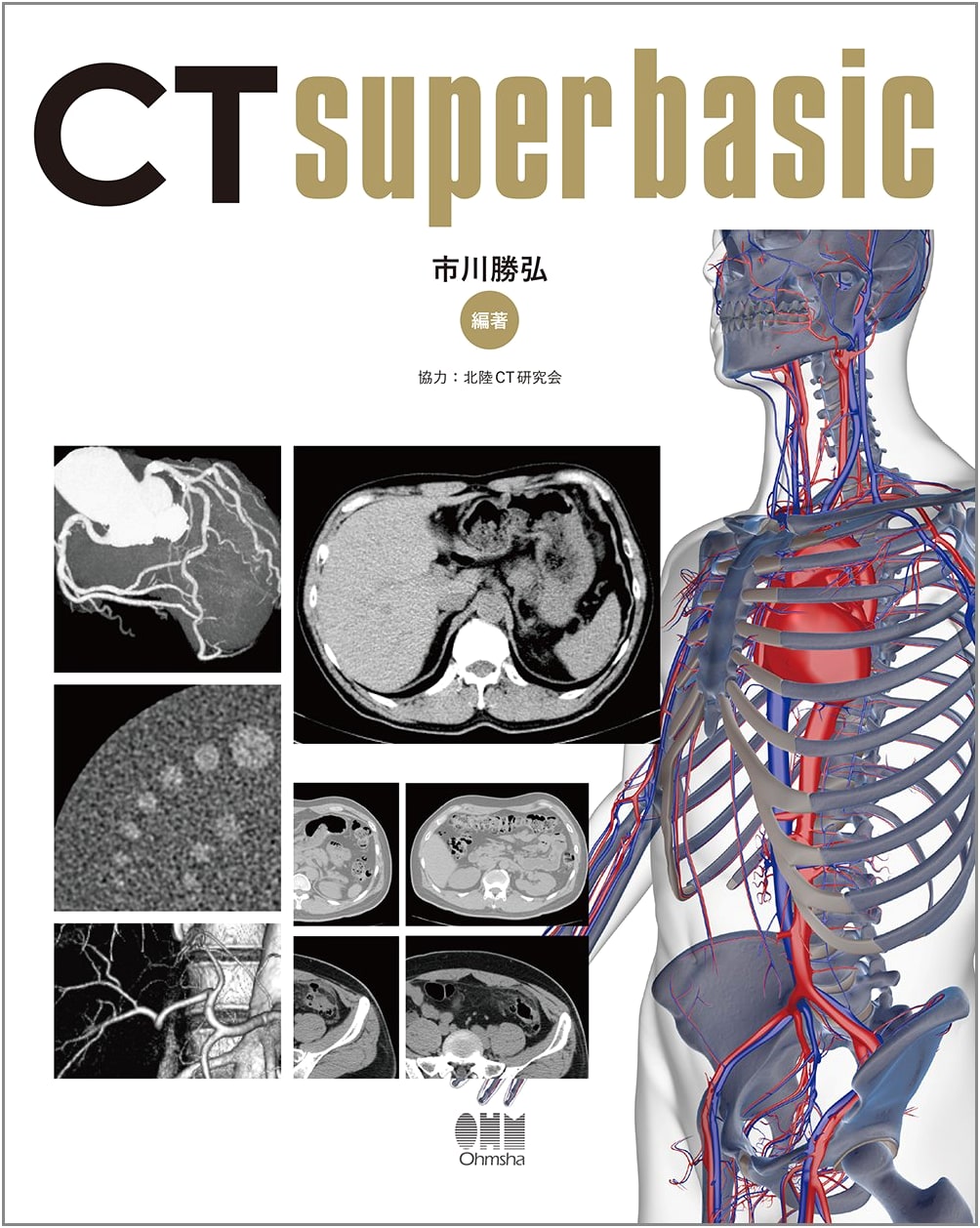CT Super Basic: An Introductory Guide to Computed Tomography