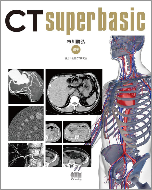 CT Super Basic: An Introductory Guide to Computed Tomography