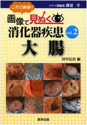 Digestive Diseases Revealed by Images: A Visual Guide to Understanding (Vol. 2)