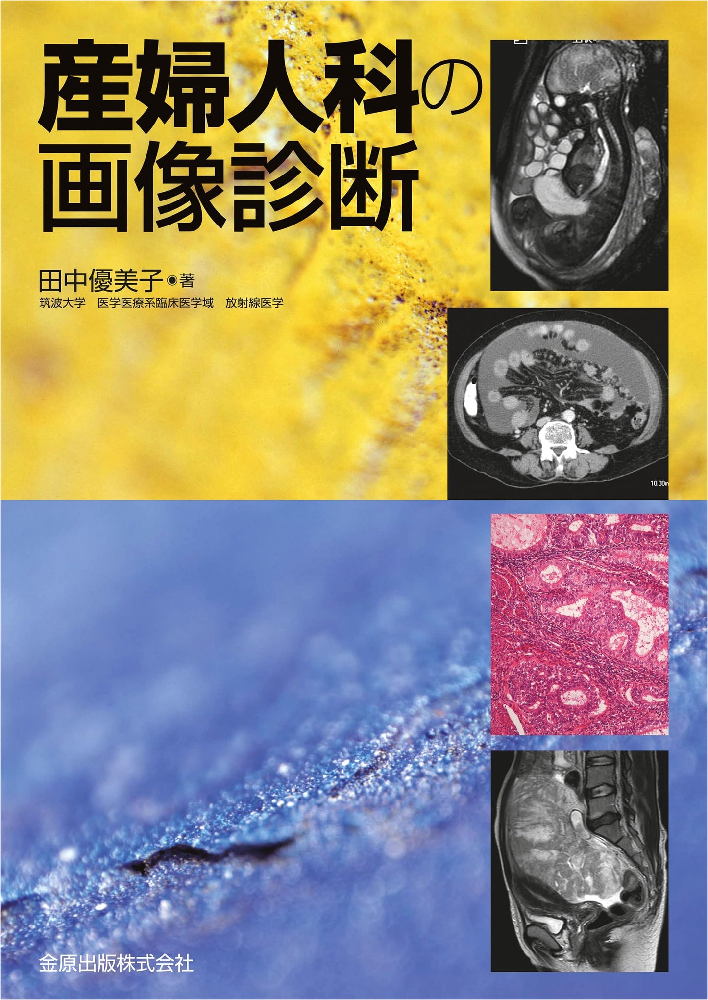Diagnostic Imaging in Obstetrics and Gynecology by Yumiko Tanaka
