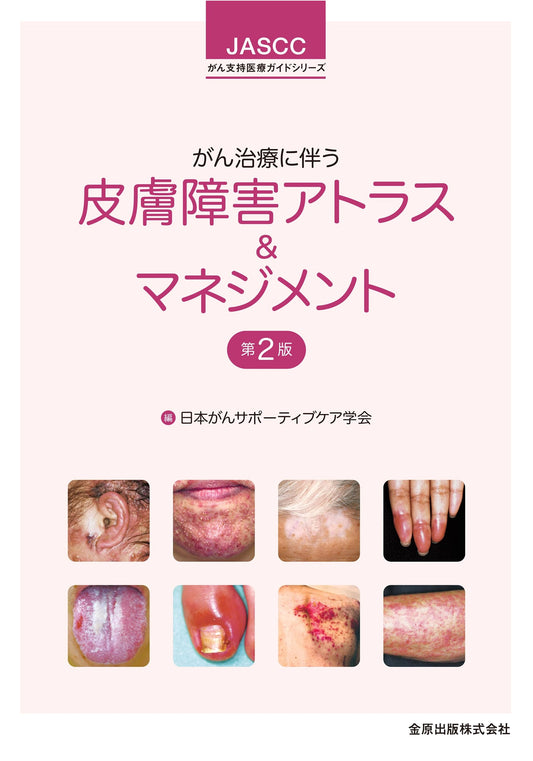 Atlas & Management of Skin Disorders Associated with Cancer Treatment, 2nd Ed.