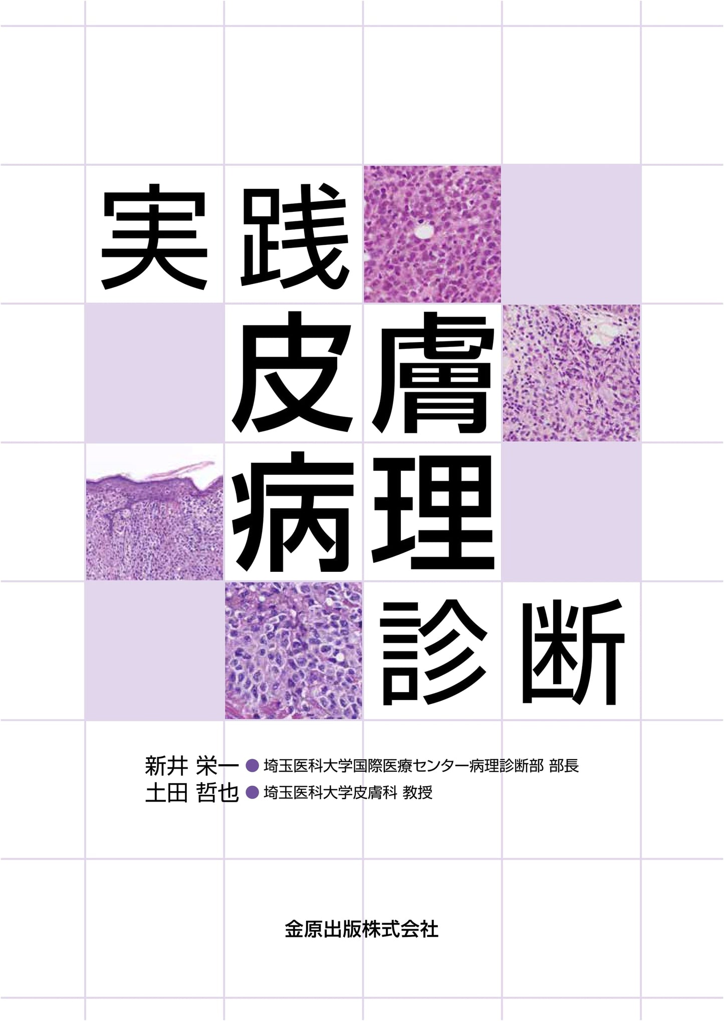 Practical Dermatopathology Diagnosis