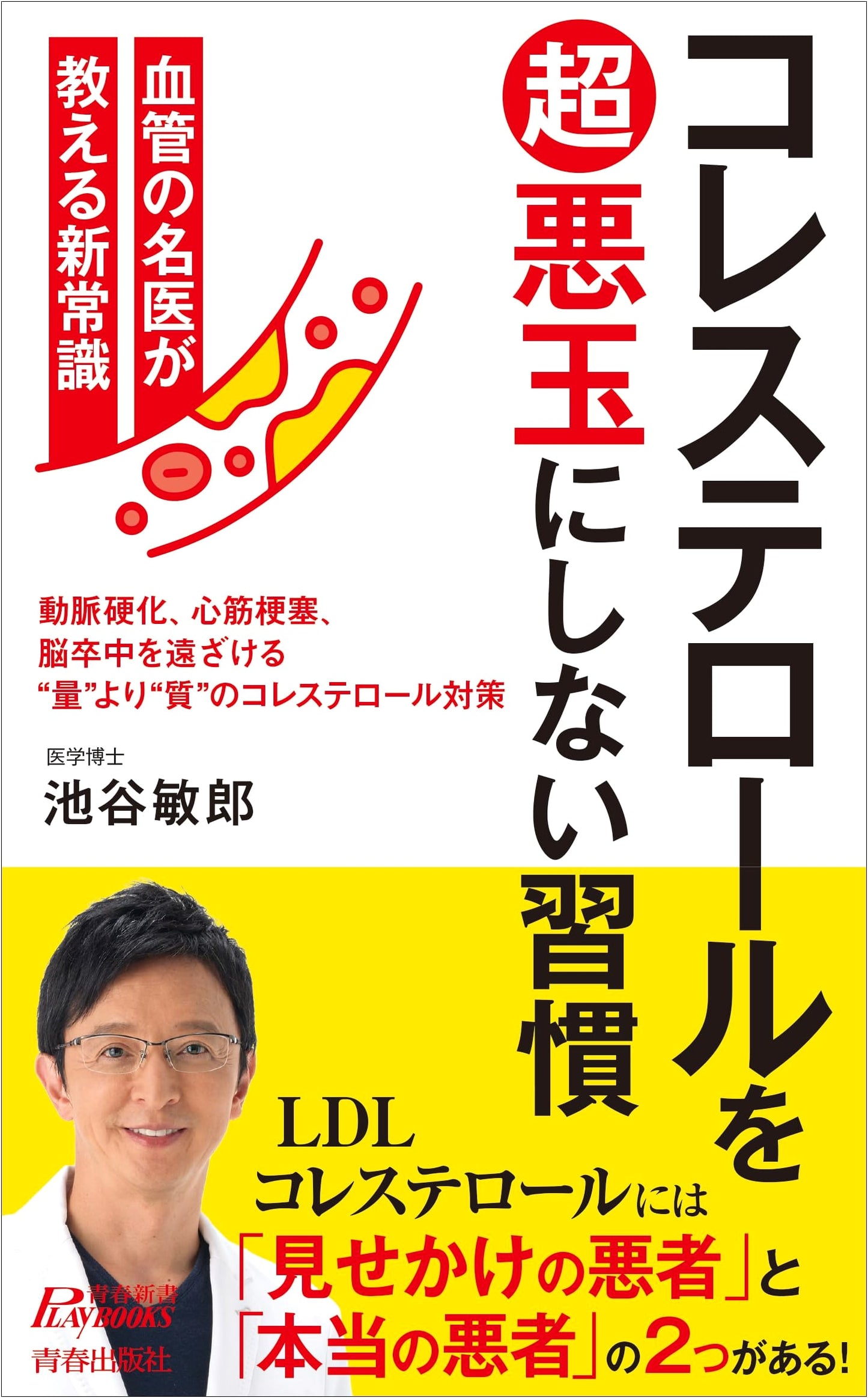 Habits to Prevent Cholesterol from Becoming 'Super Bad' (Seishun Shinsho Play Books P 1241)