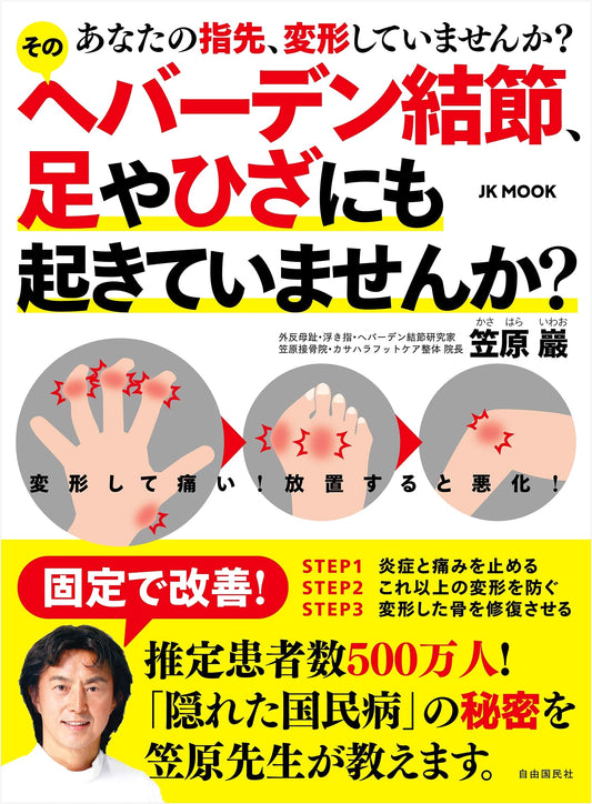 Heberden's Nodes: Are Your Finger Joints Deformed? Also Affecting Feet & Knees? (JK MOOK)