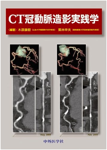 CT Coronary Angiography: A Practical Guide