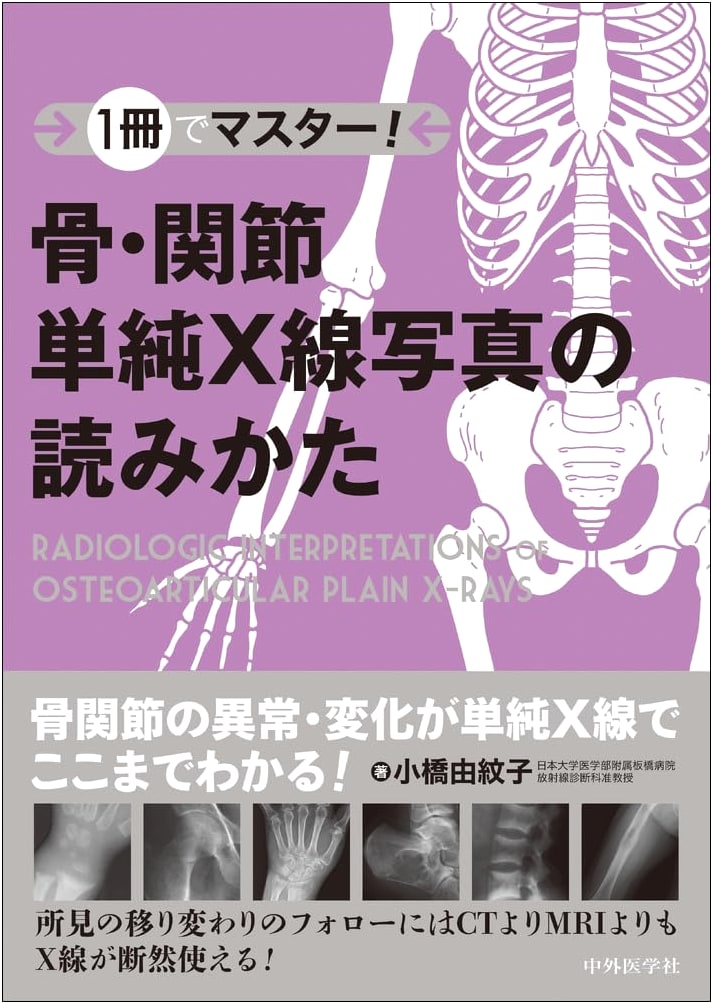 Mastering Bone and Joint Plain X-Ray Interpretation: A Comprehensive Guide