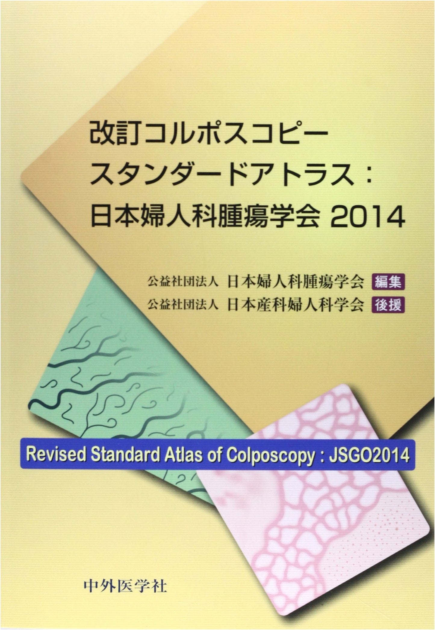 Revised Colposcopy Standard Atlas: Japanese Society of Gynecologic Oncology 2014