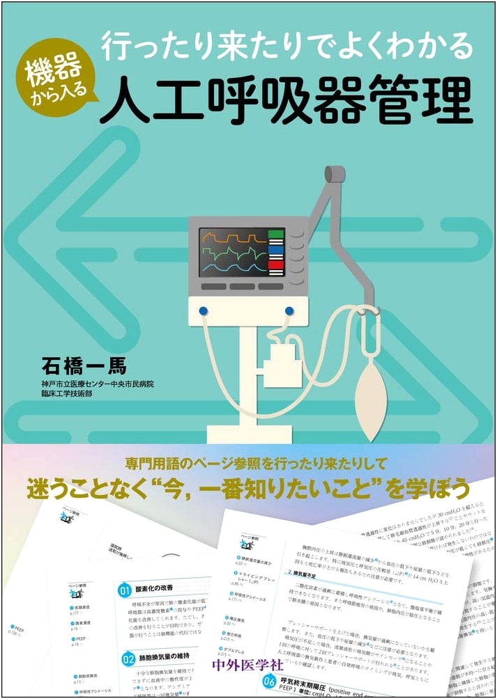 Understanding Ventilator Management from Equipment: A Back-and-Forth Approach