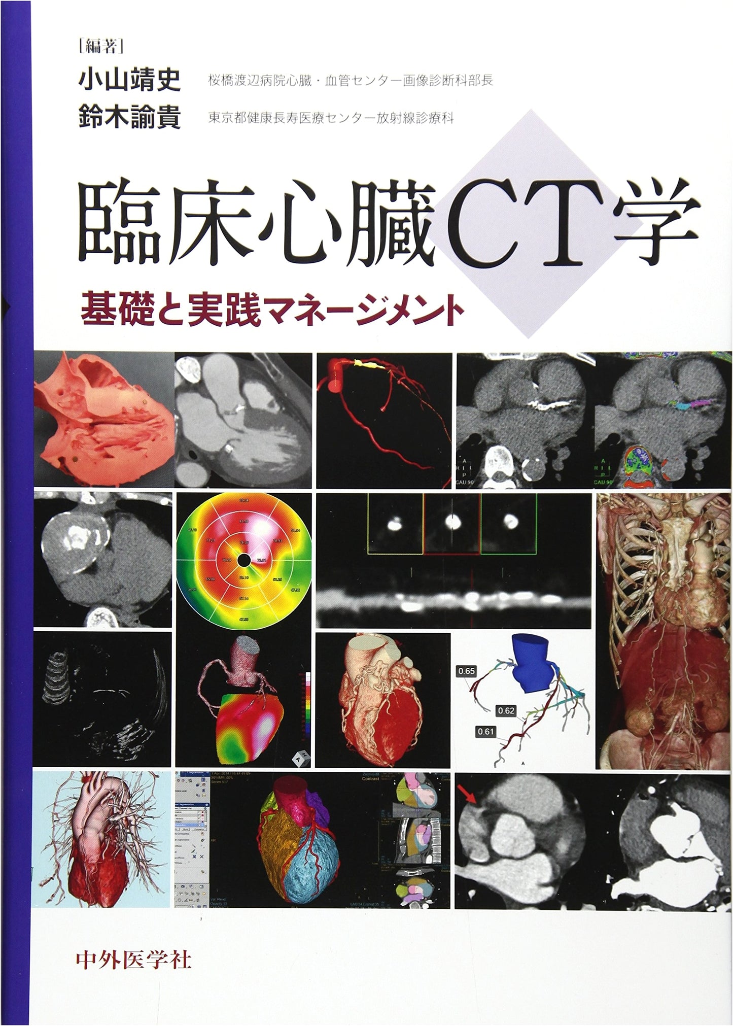 Clinical Cardiac CT: Fundamentals and Practical Management