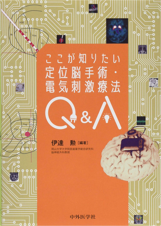Stereotactic Brain Surgery & Electrical Stimulation Therapy Q&A: What You Want to Know