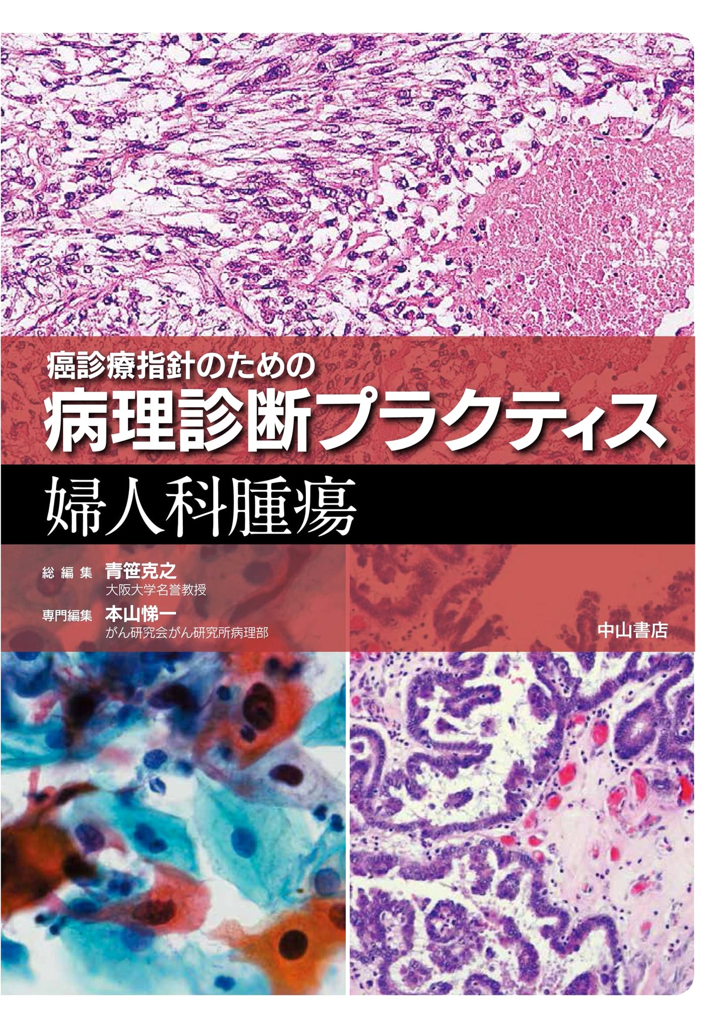 Gynecologic Tumors: Pathology Practice for Cancer Treatment Guidelines