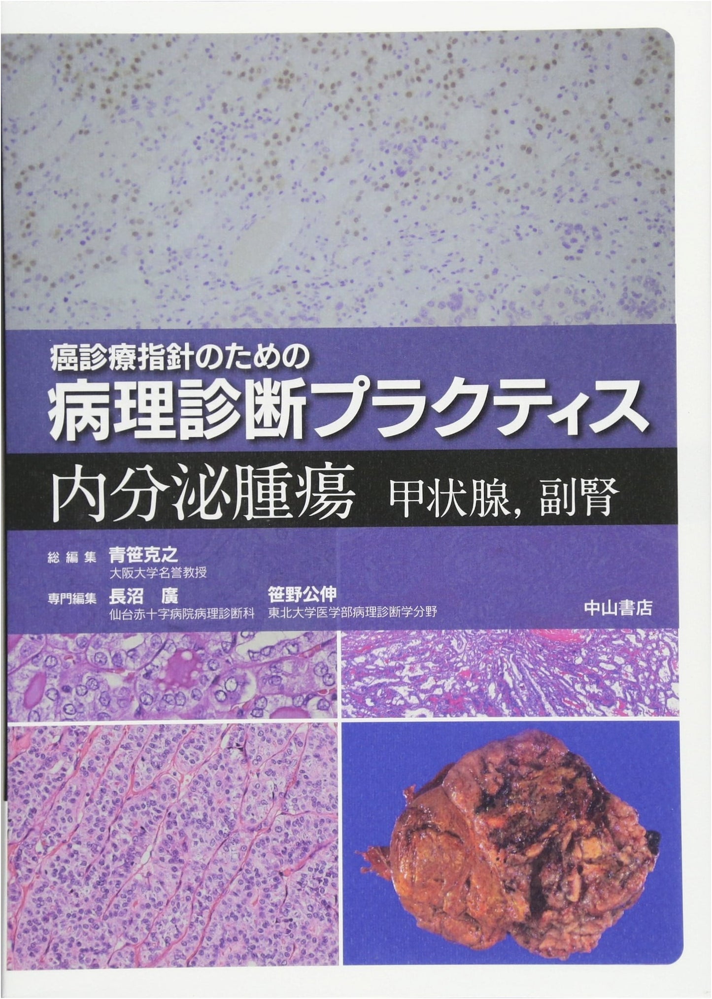 Pathological Diagnosis of Endocrine Tumors: Thyroid & Adrenal Glands (Cancer Guidelines)